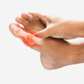 The Power of Homeopathy in Managing High Uric Acid Levels