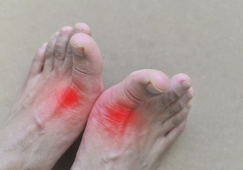The Power of Stress Management in Homeopathic Treatment for Uric Acid